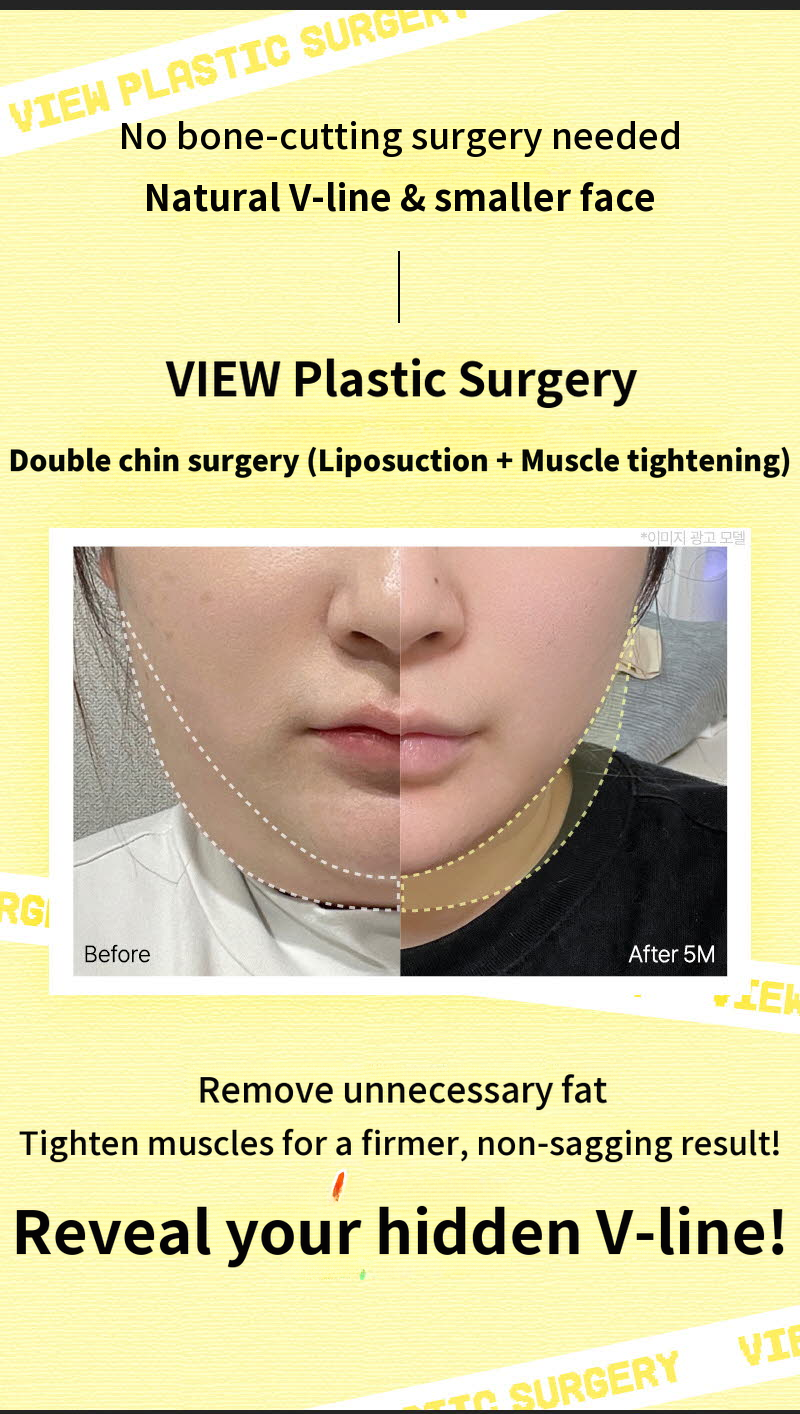 ❤View❤Facial Liposuction