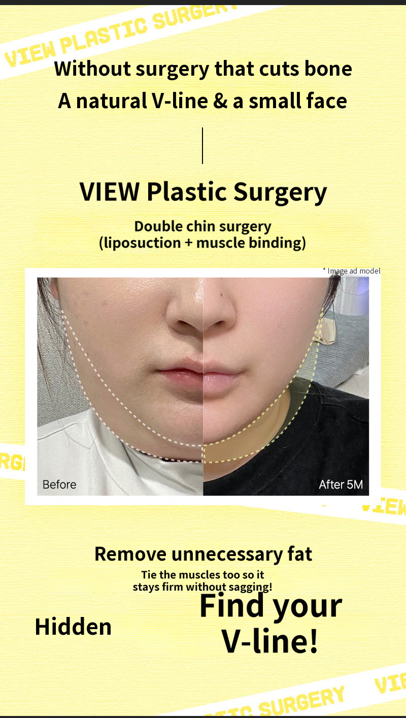 ❤View❤Facial Liposuction