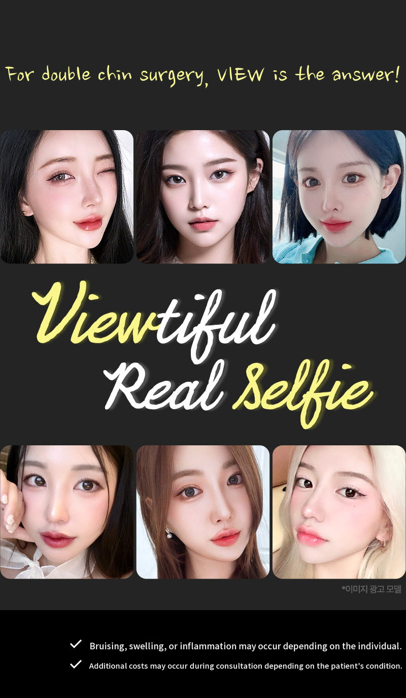 ❤View❤Facial Liposuction