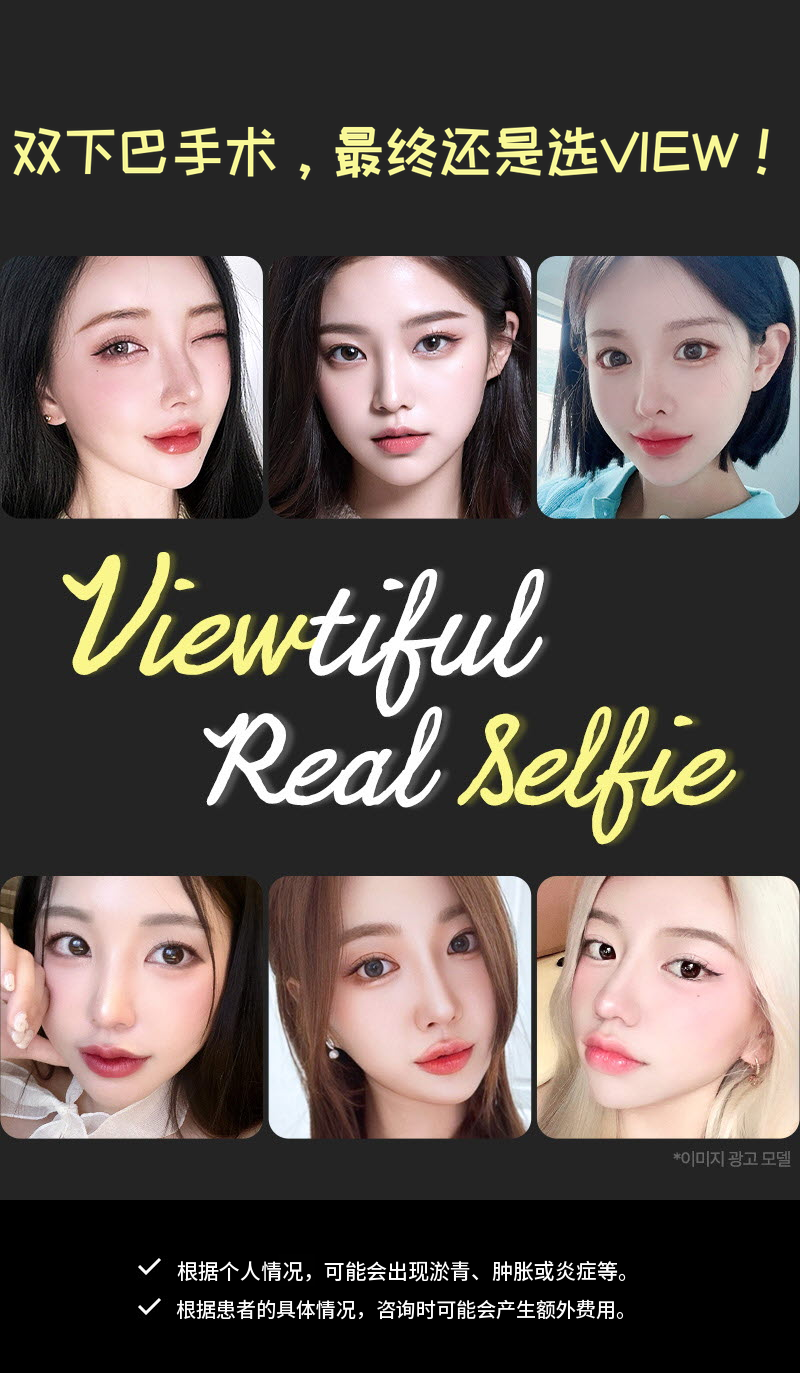 ❤视美❤面部吸脂