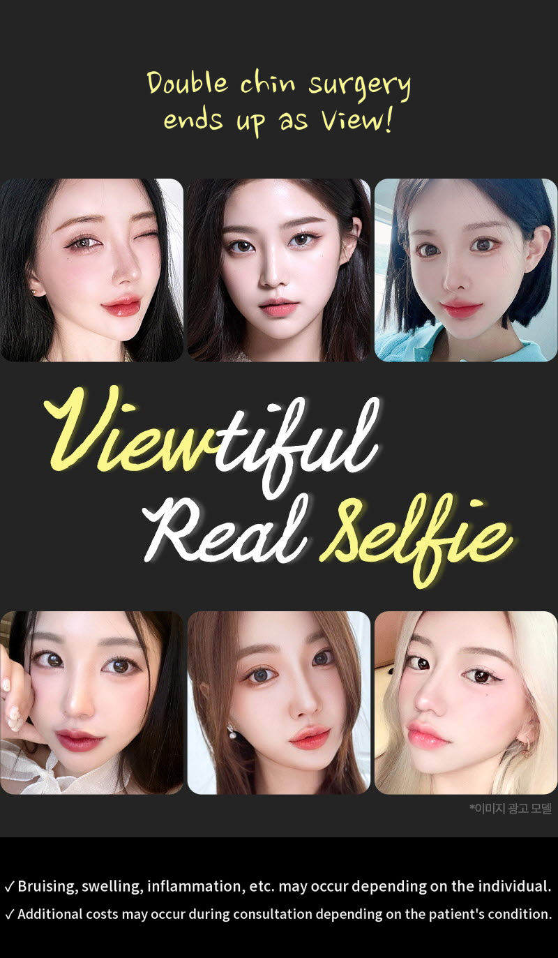 ❤View❤Facial Liposuction