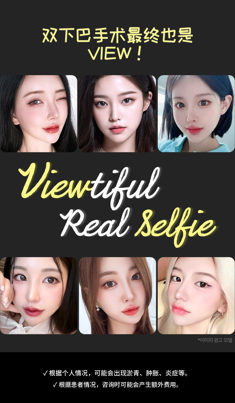 ❤视图❤面部抽脂