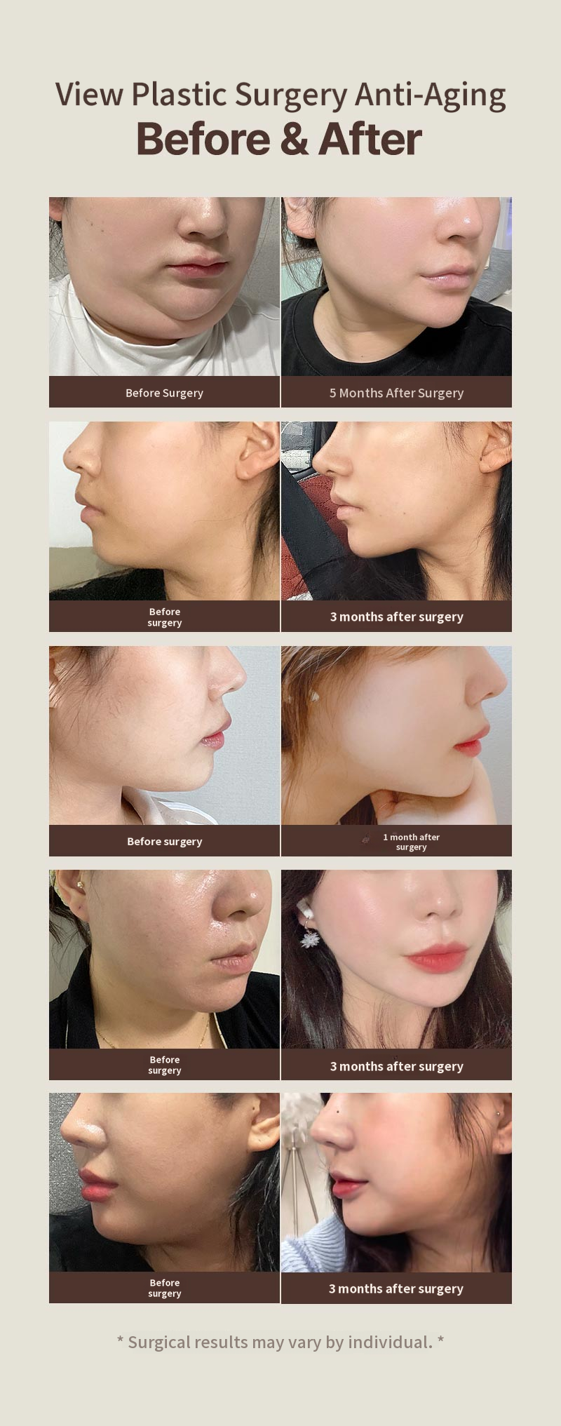 ❤View❤ Facial Liposuction