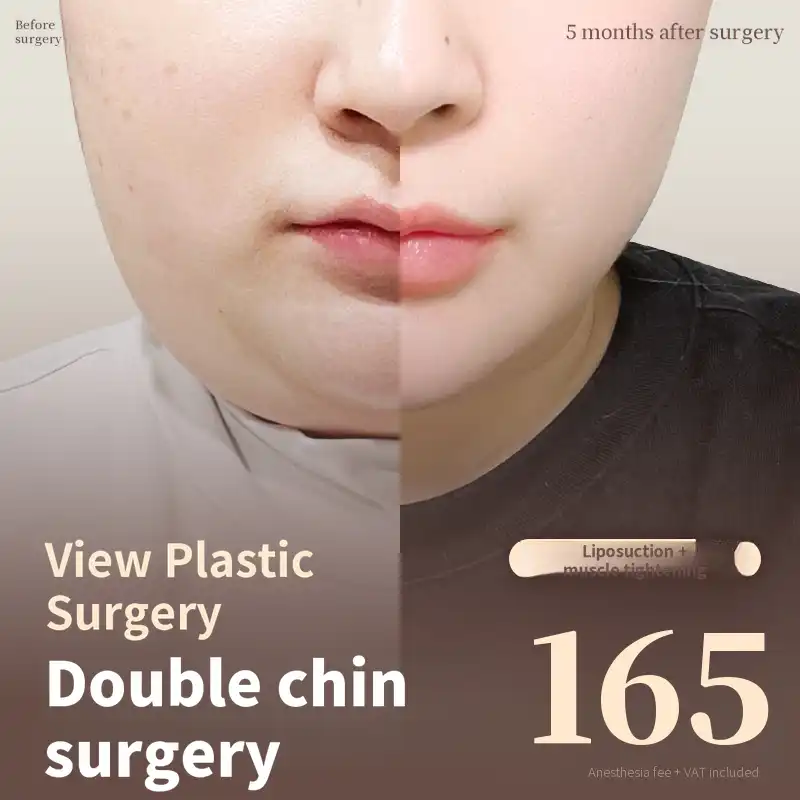 ❤View❤ Facial Liposuction