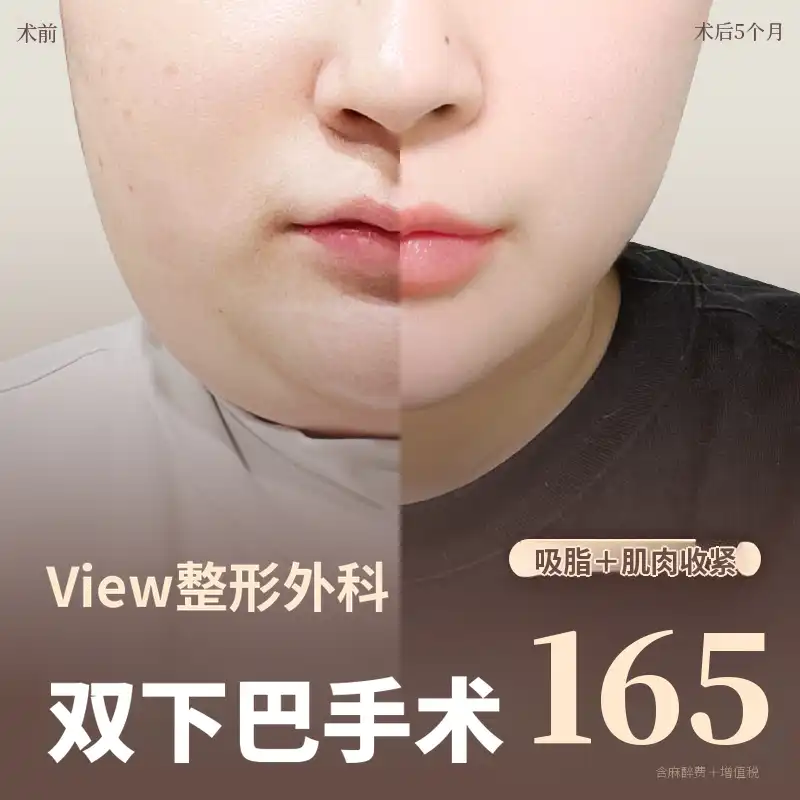 ❤美❤面部吸脂
