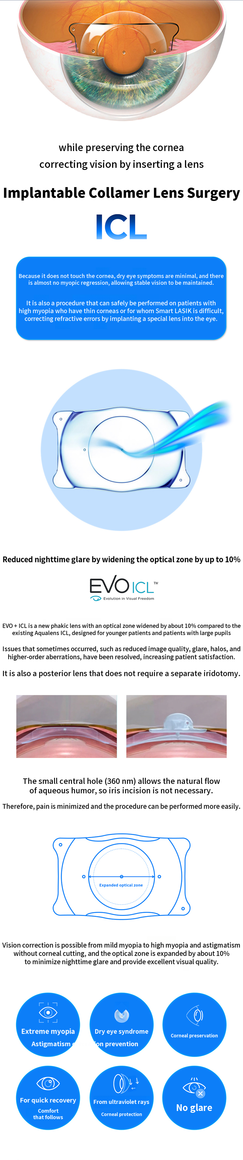 Bright Sharing Lens Implant Surgery ICL