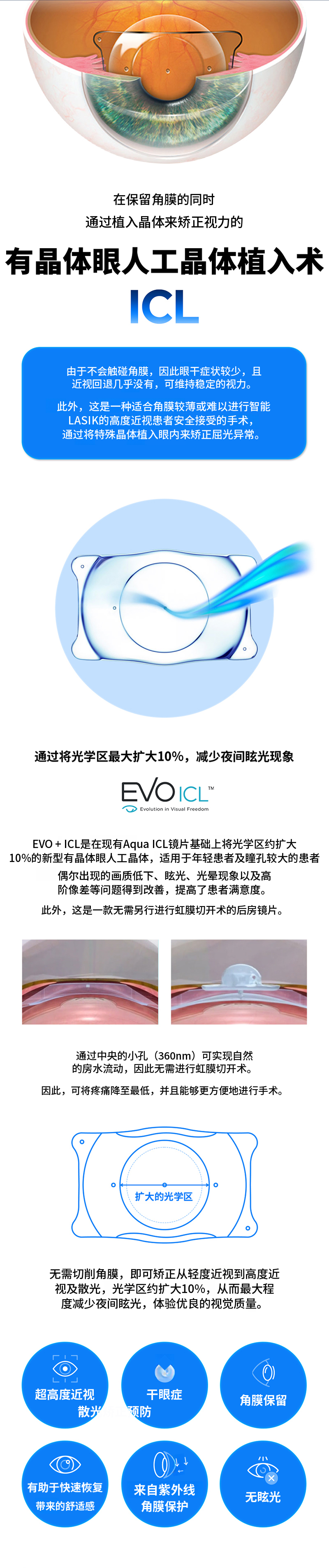 明亮共享人工晶体植入术 ICL