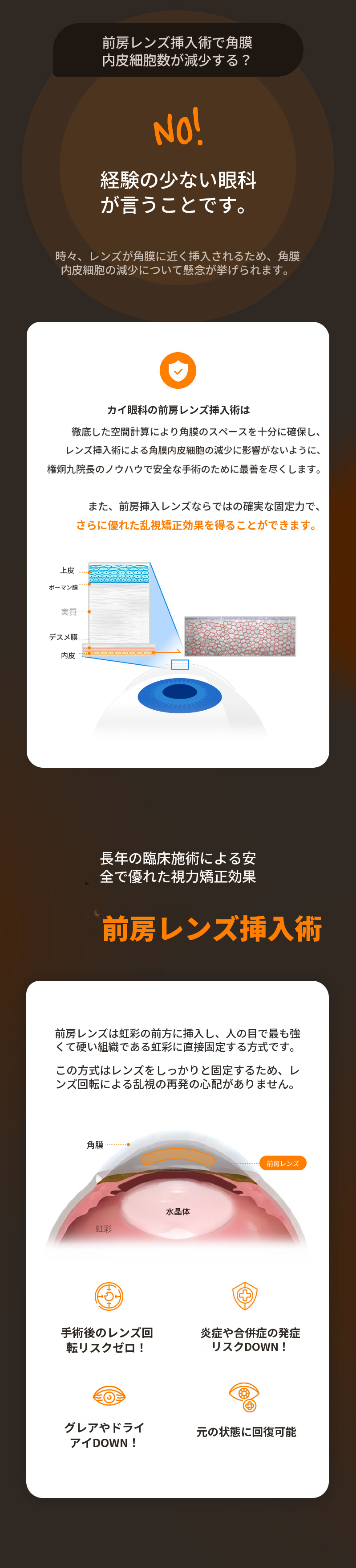 最も安全なガイドレンズ挿入手術