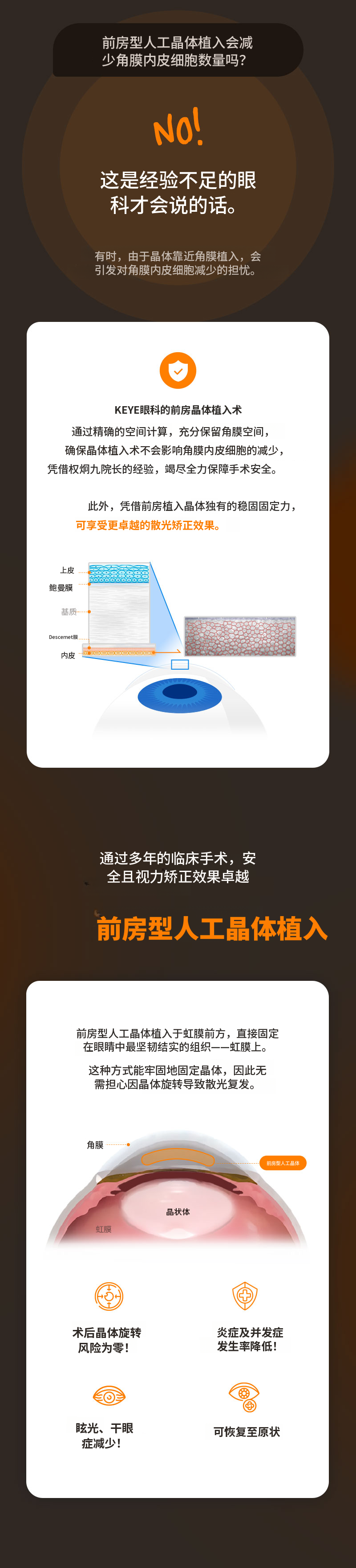 最安全的引导镜片植入术