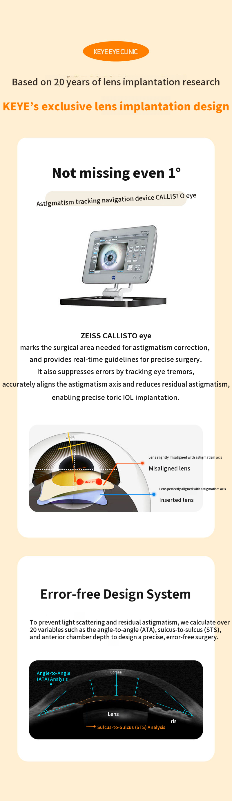 The safest guide lens implantation