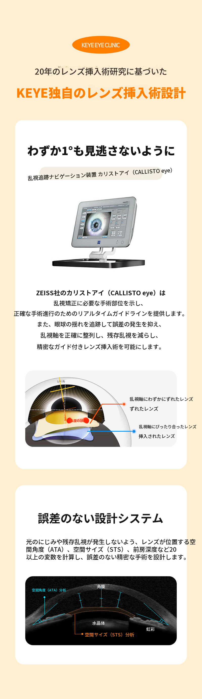 最も安全なガイドレンズ挿入手術