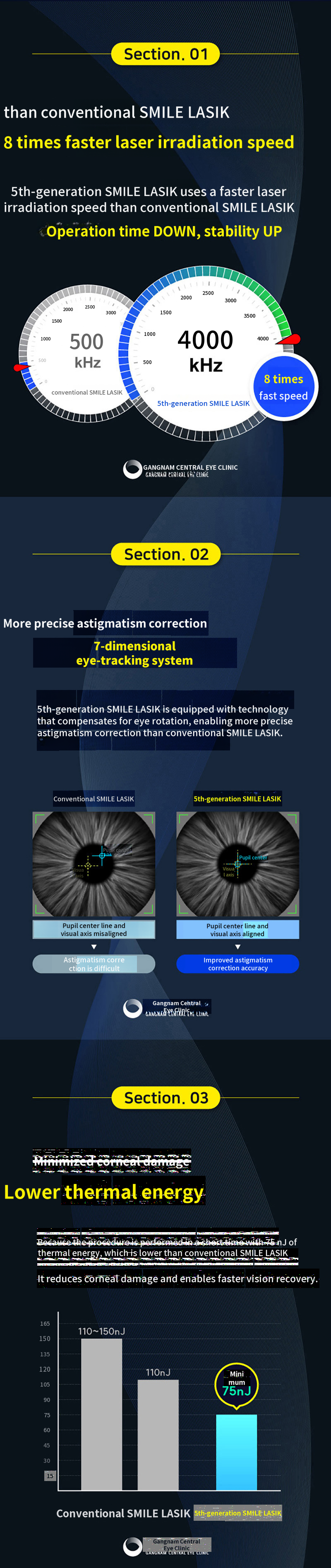 Personalized 5th Generation Smart Smile LASIK