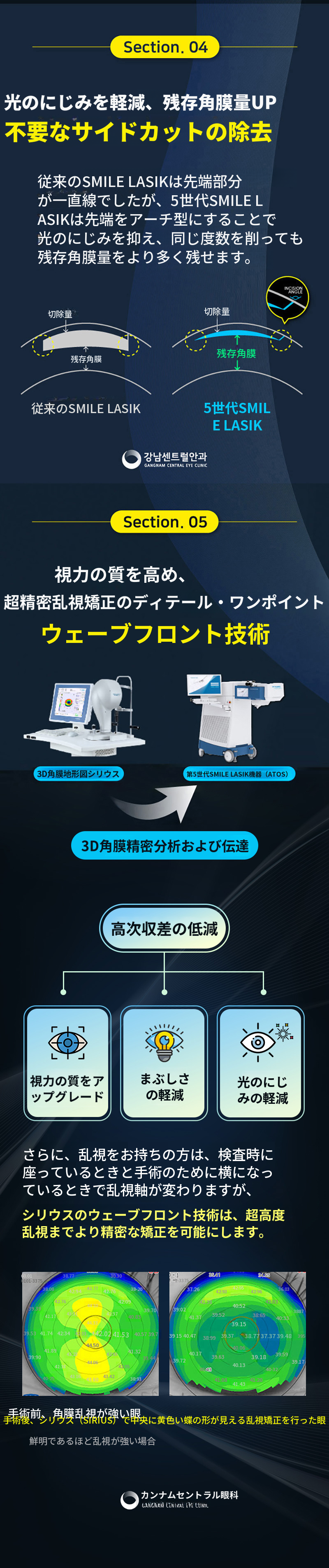 個人に合わせた第5世代スマートスマイルラシック