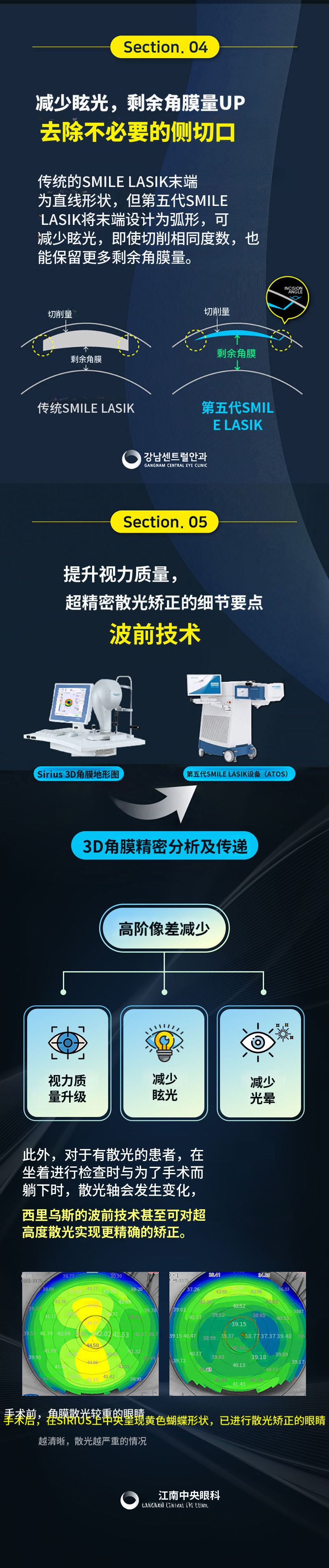 个性化第五代智能微笑激光矫正