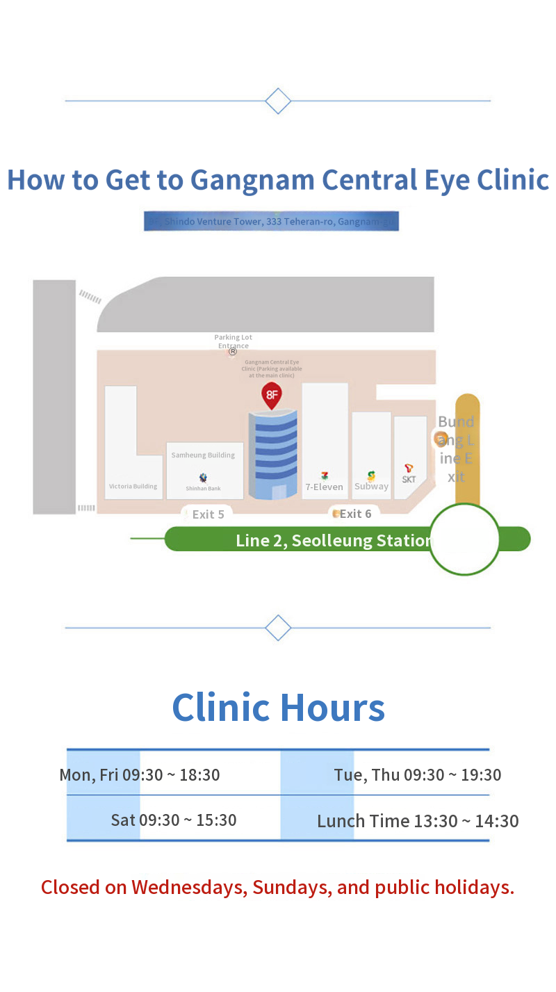 Personalized 5th Generation Smart Smile LASIK