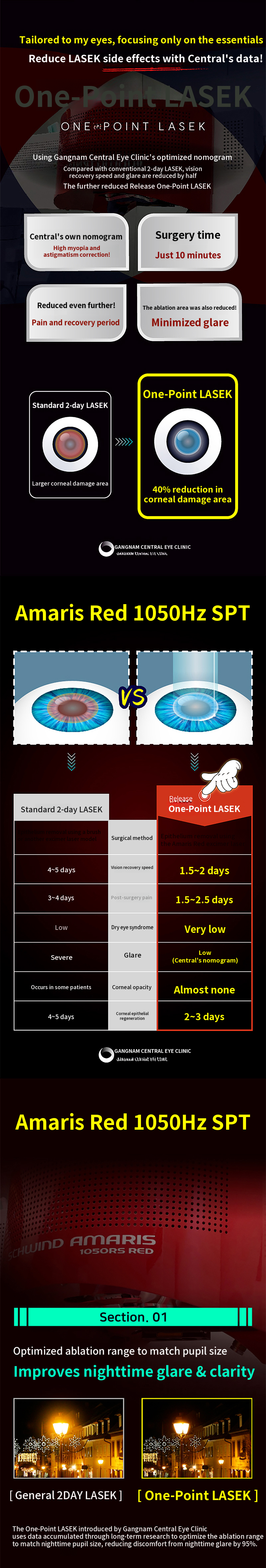 1.5 days recovery, One-point LASIK