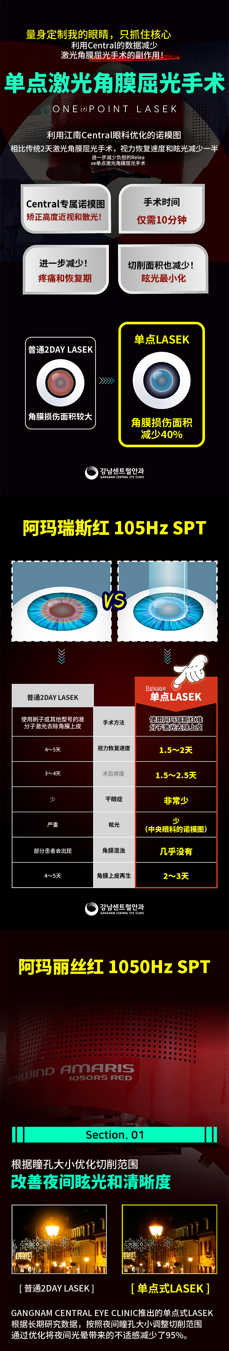 仅需1.5天恢复，单点LASEK