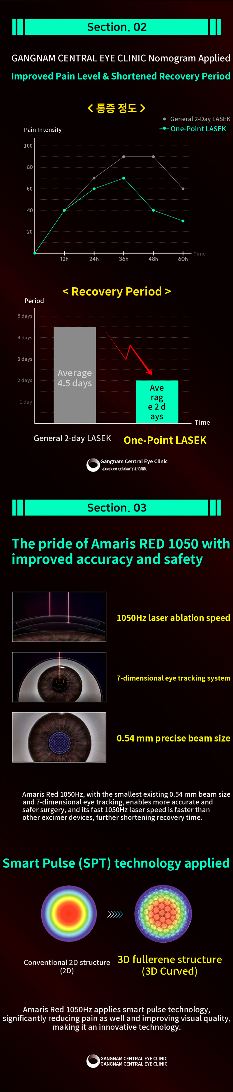 1.5 days recovery, One-point LASIK