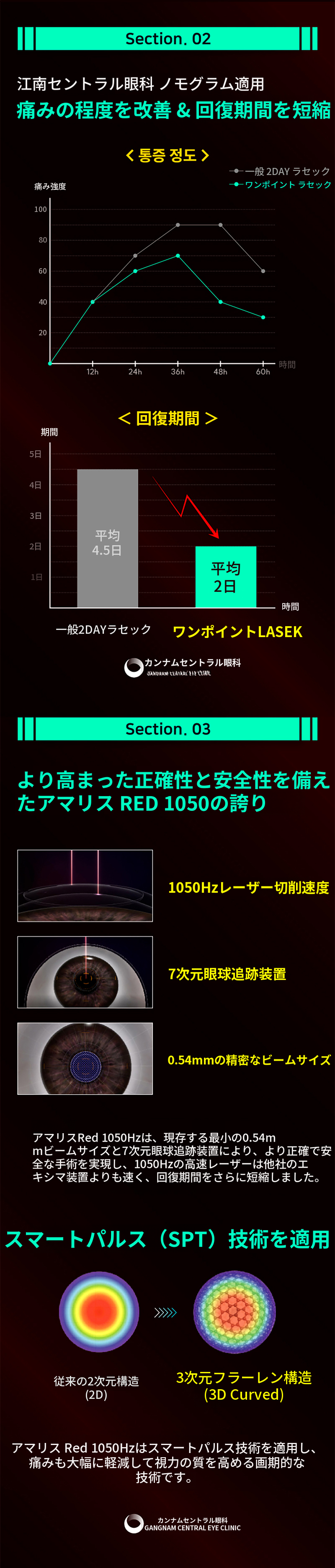 ただし、1.5日の回復、ワンポイントレーシック