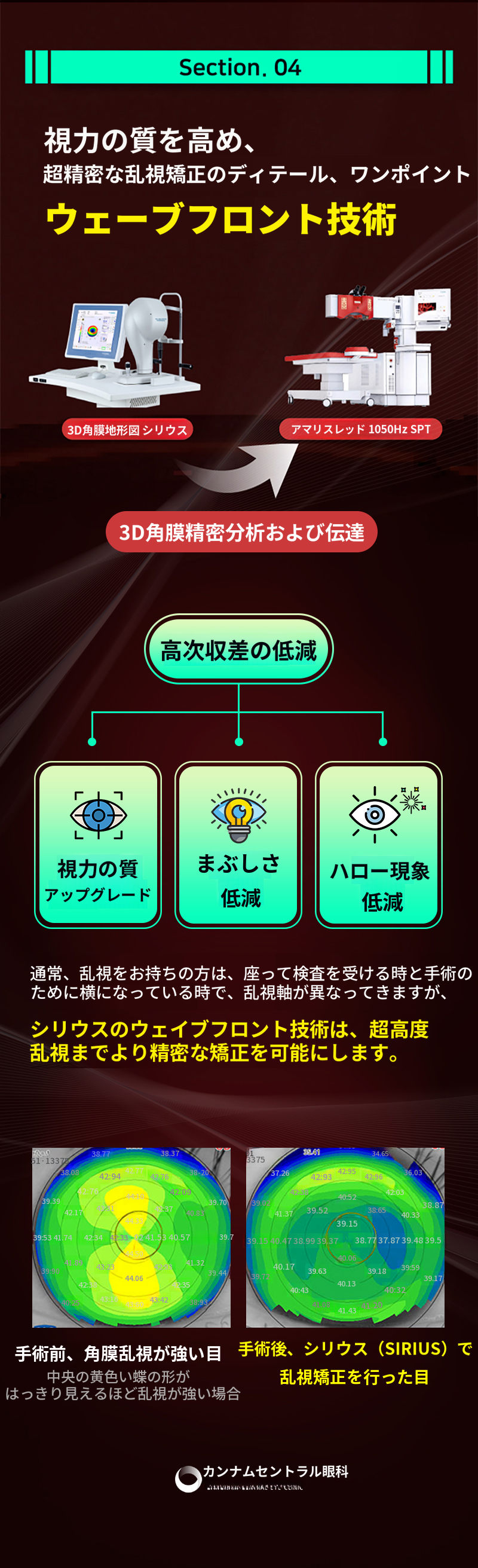 ただし、1.5日の回復、ワンポイントレーシック