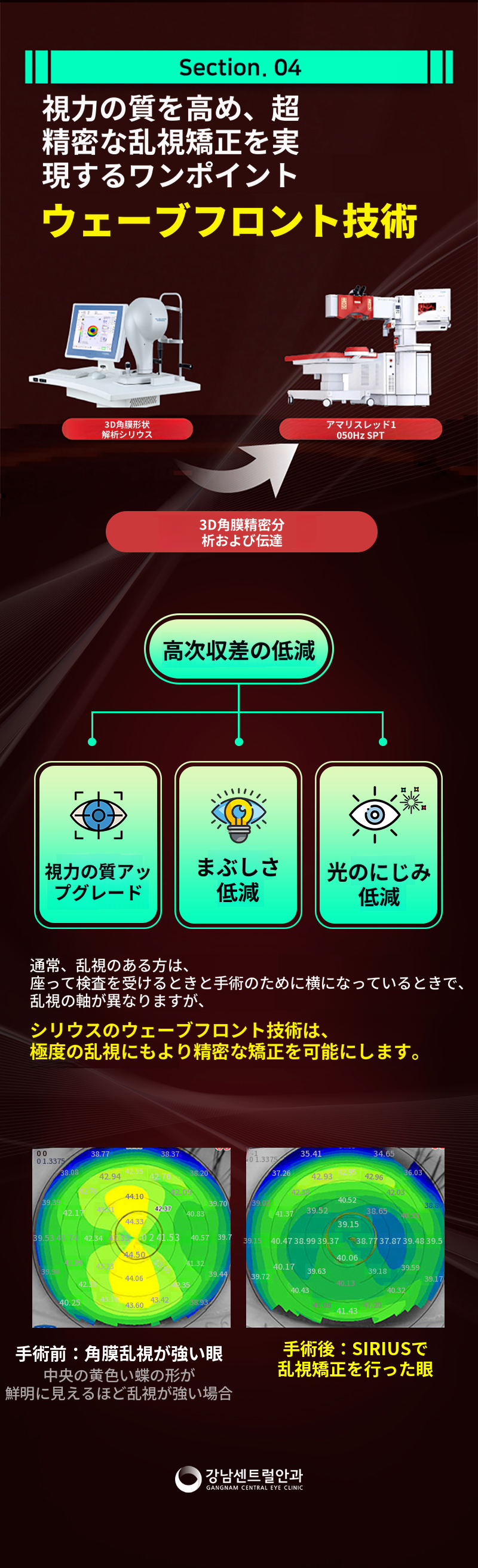 わずか1.5日で回復、ワンポイント・ラセック