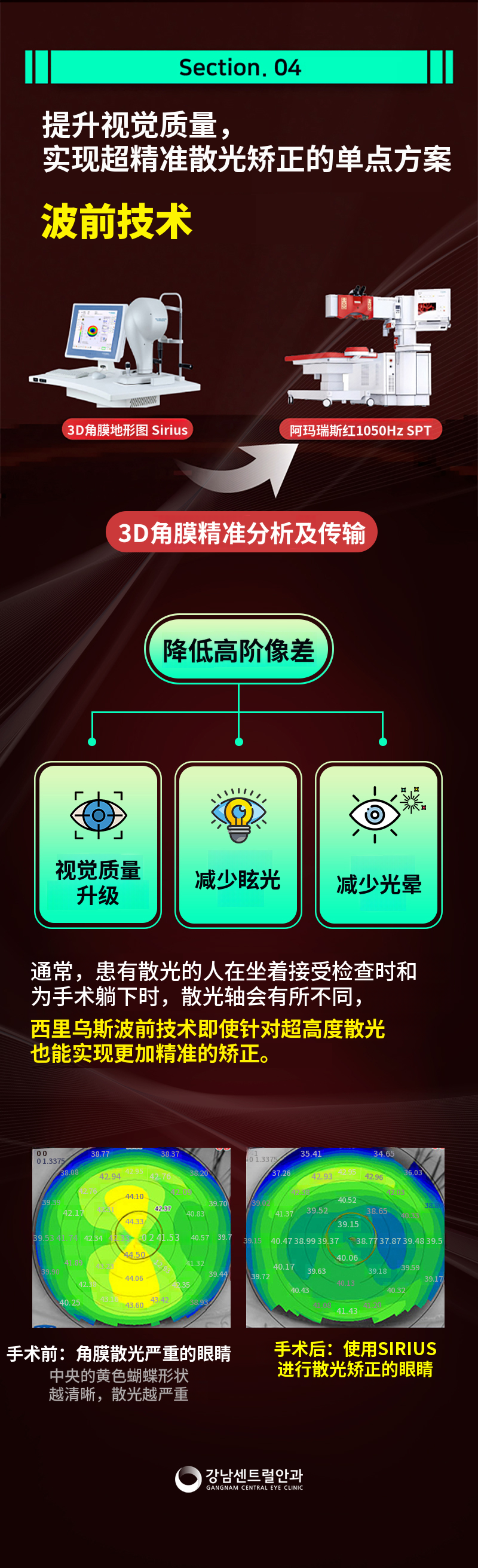 仅需1.5天恢复，单点LASEK