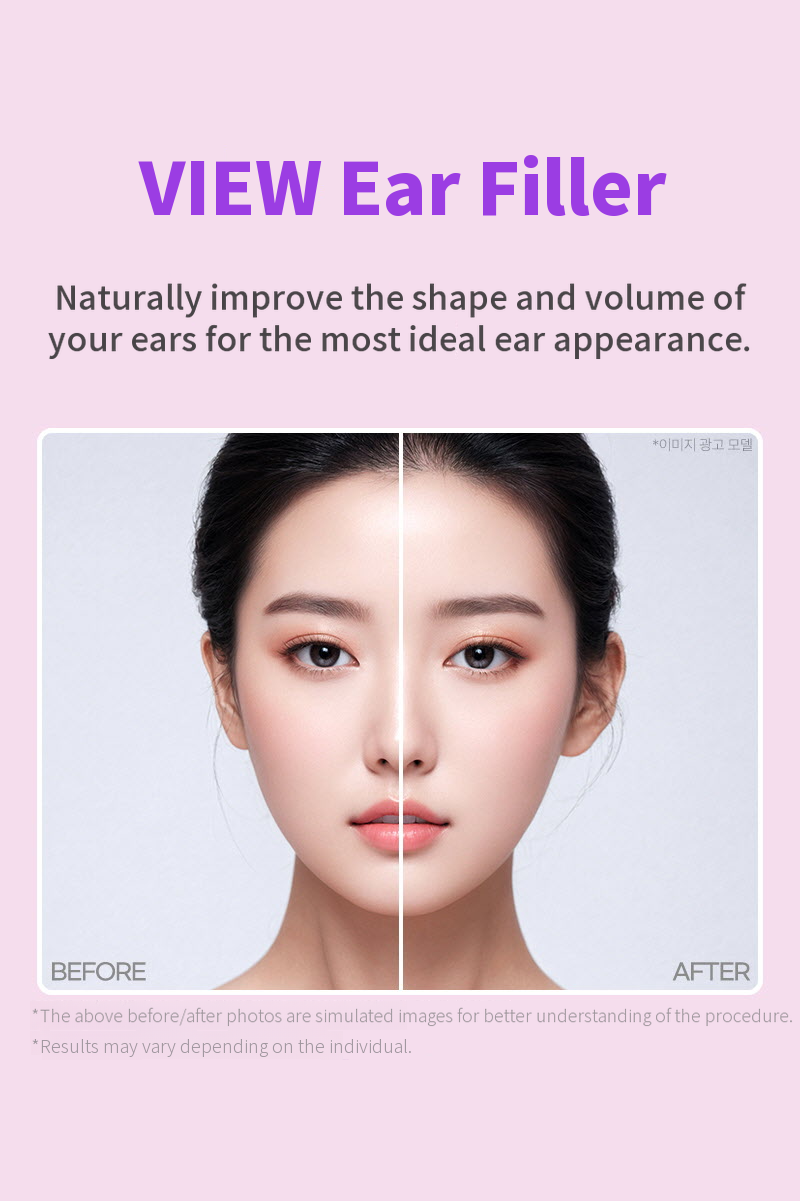 ❤View❤Ear Filler (Import Genuine Product)