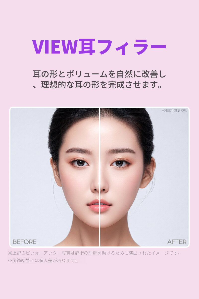 ❤ビュ❤耳フィラー（輸入正規品）