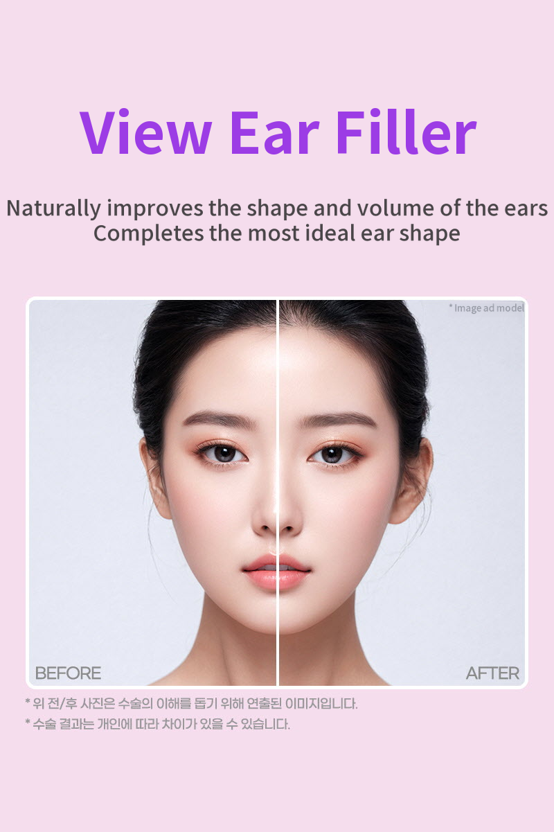 ❤View❤ Ear Filler (Imported Genuine Product)