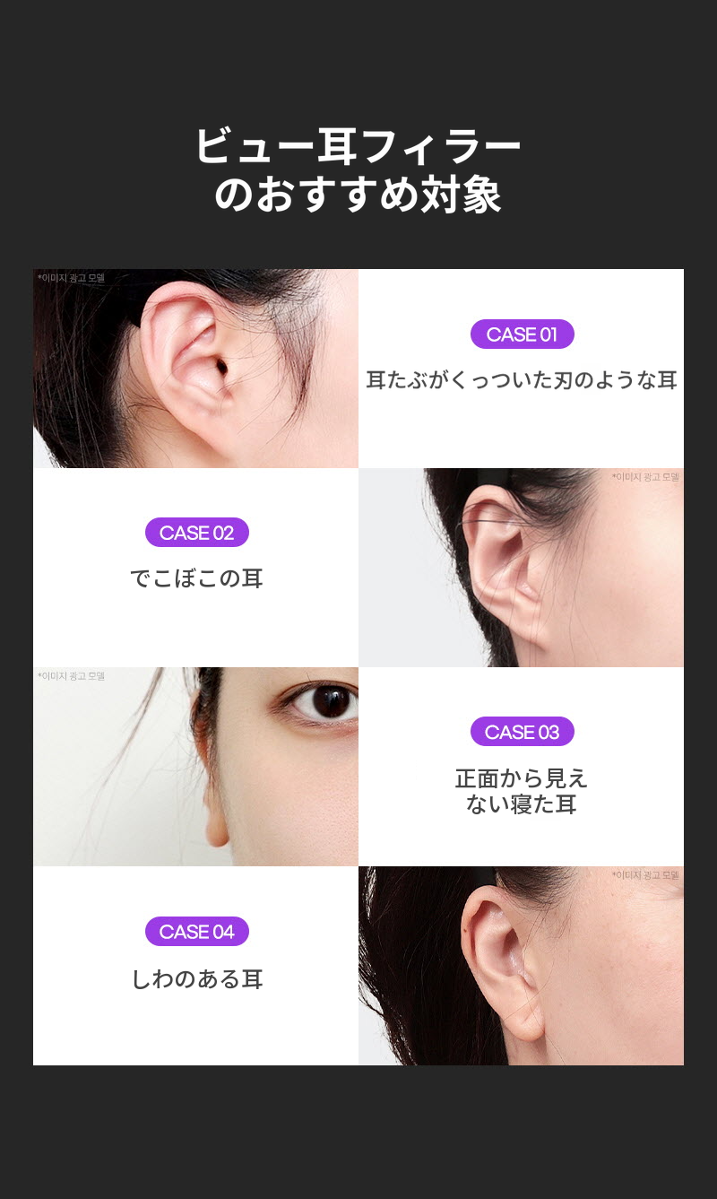 ❤ビュー❤耳フィラー (輸入正品)