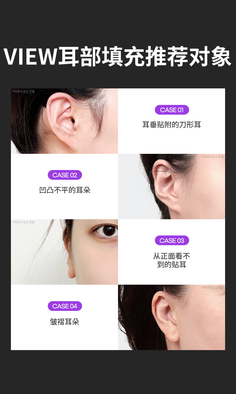 ❤视图❤耳部填充剂 (进口正品)