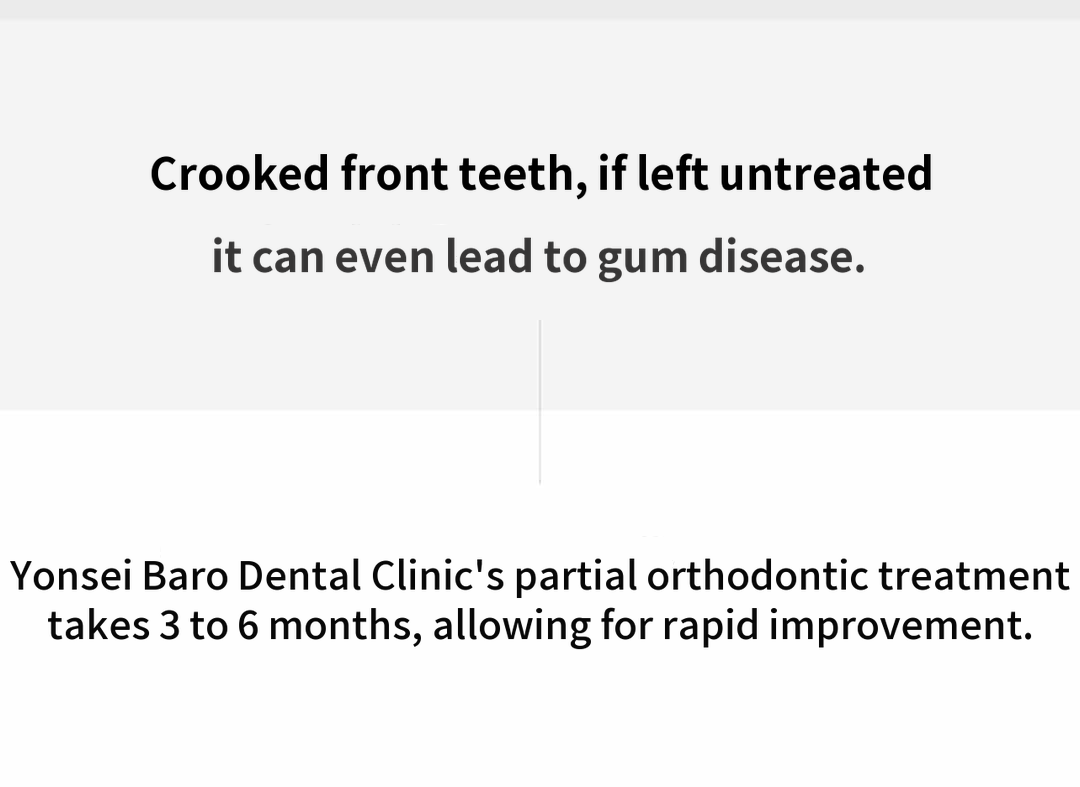 Yonsei Baro - Rapid Front Tooth Orthodontics