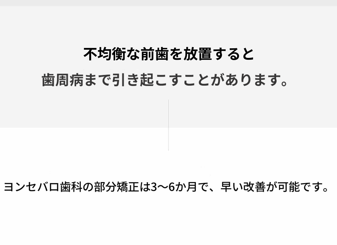 延世バロ-前歯の速成矯正