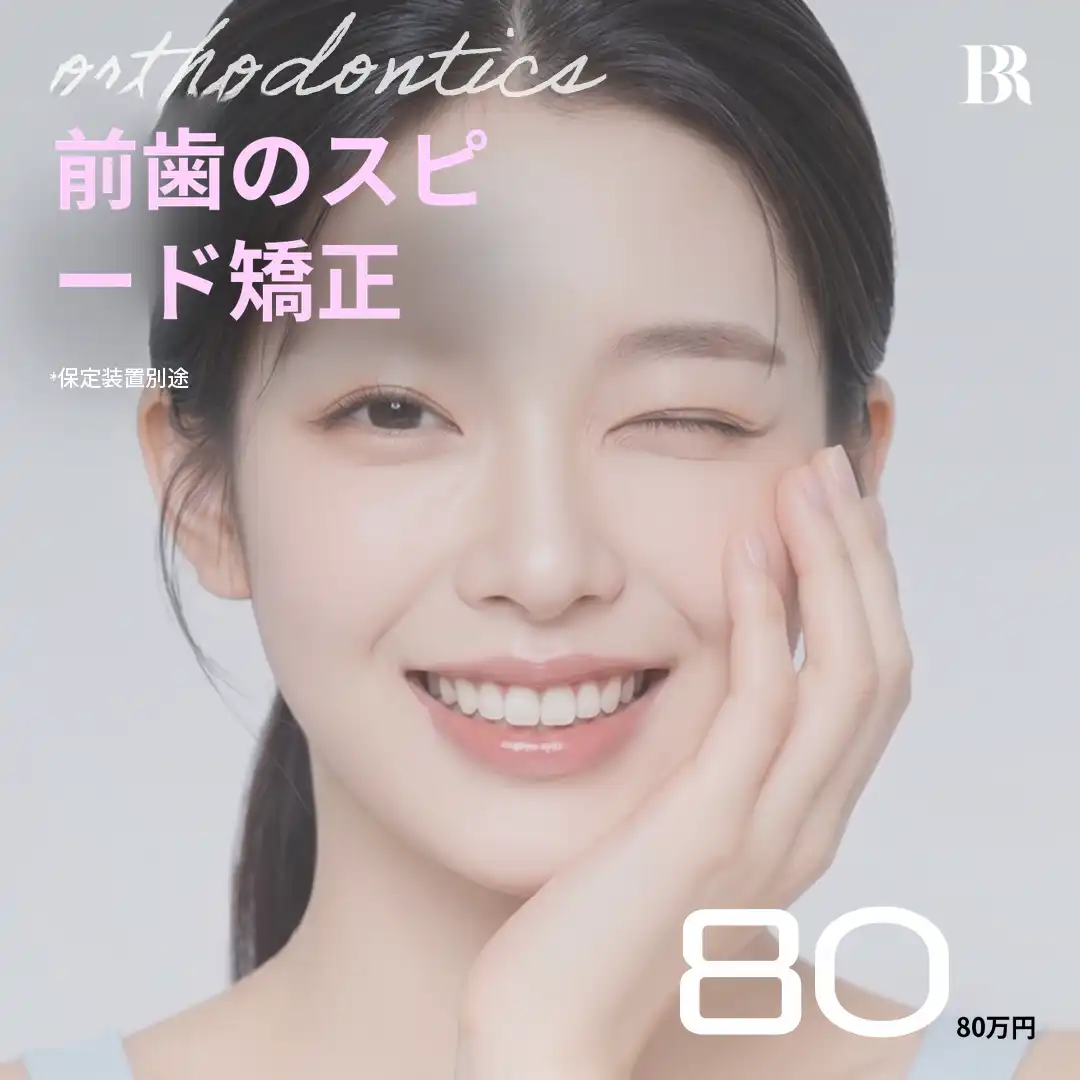 연세バロ-前歯迅速矯正