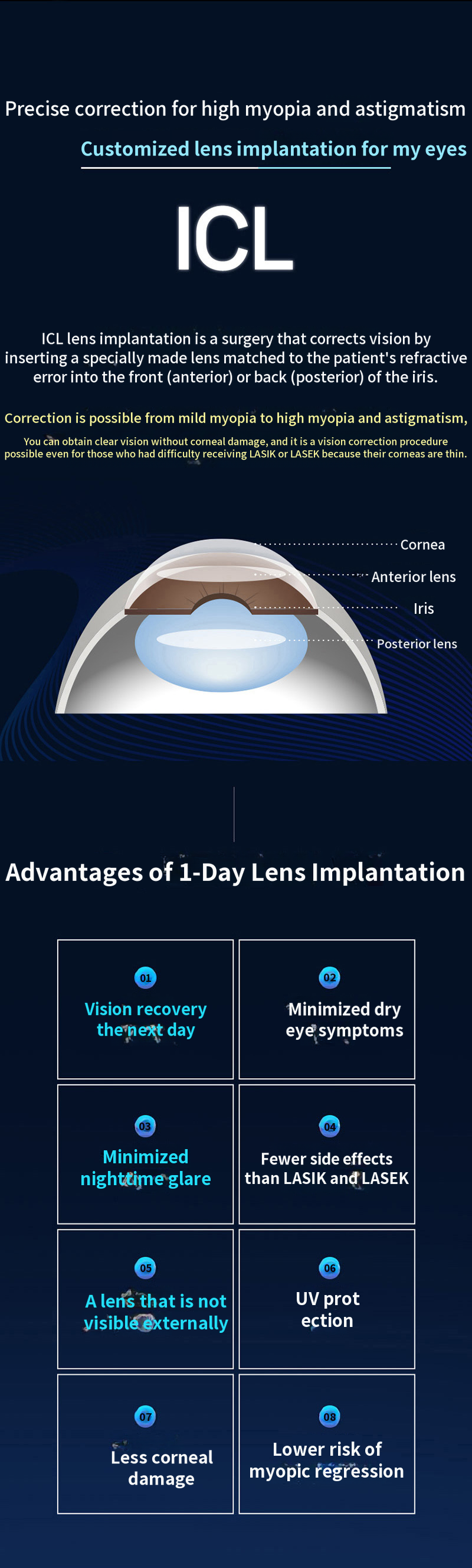 Personalized 1-Day Lens Insertion Surgery