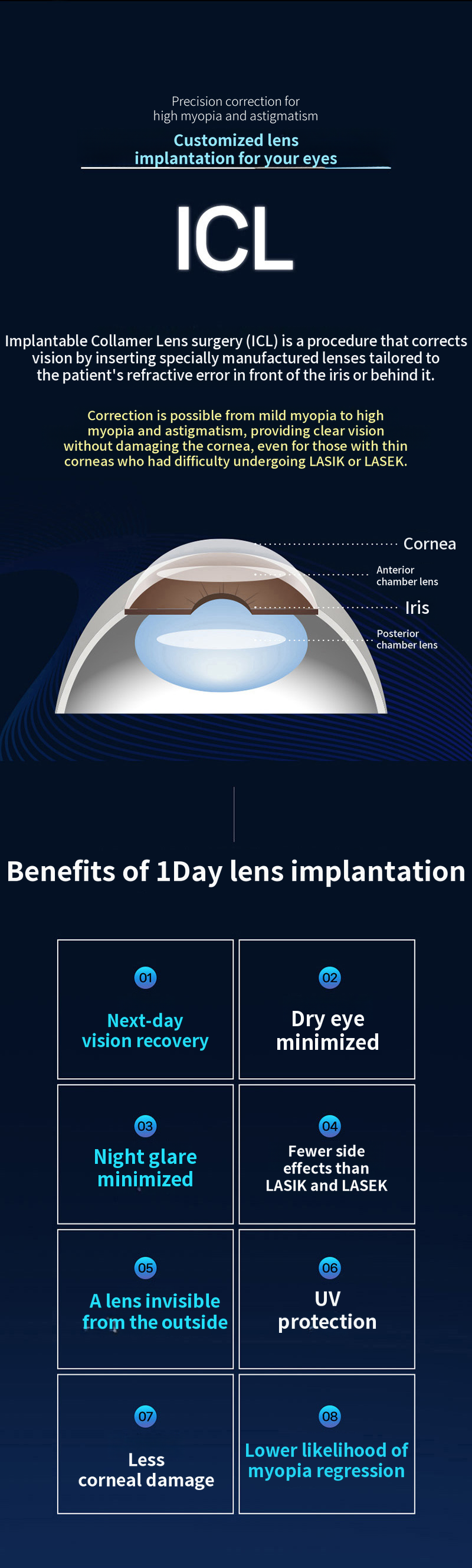 Personalized, 1-Day ICL Surgery