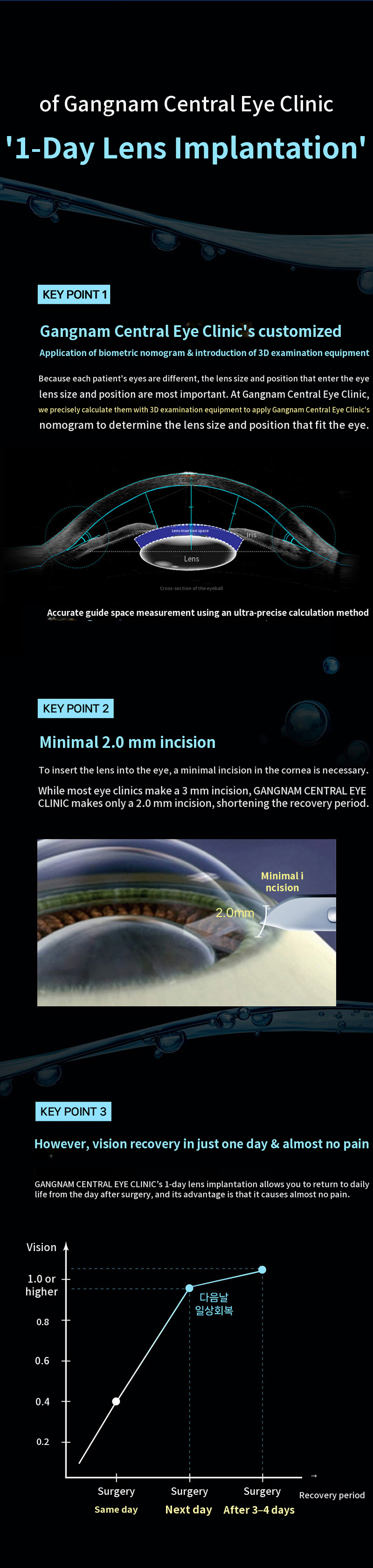 Personalized 1-Day Lens Insertion Surgery