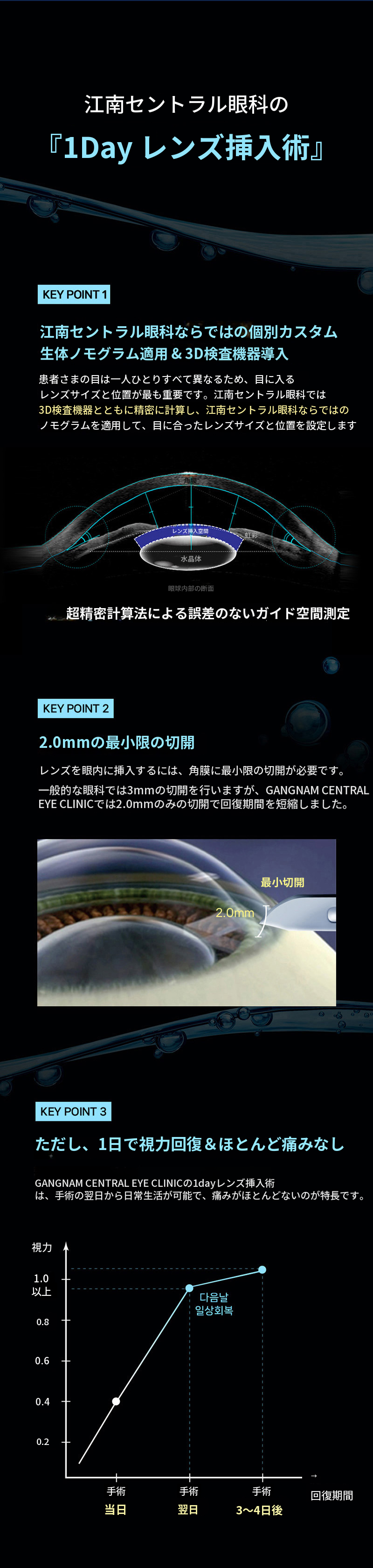 個人に合わせた1日レンズ挿入手術