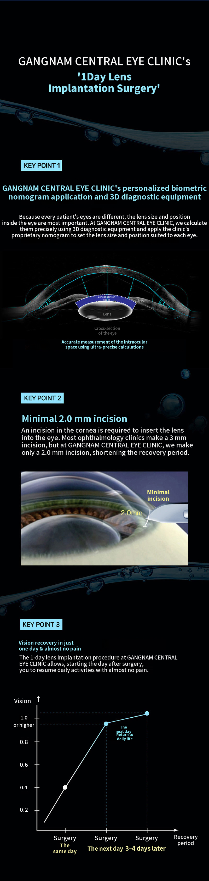 Personalized, 1-Day ICL Surgery
