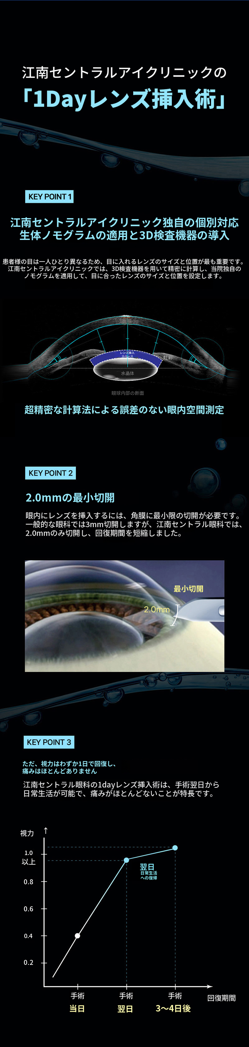 一人ひとりに合わせた、1day ICL手術