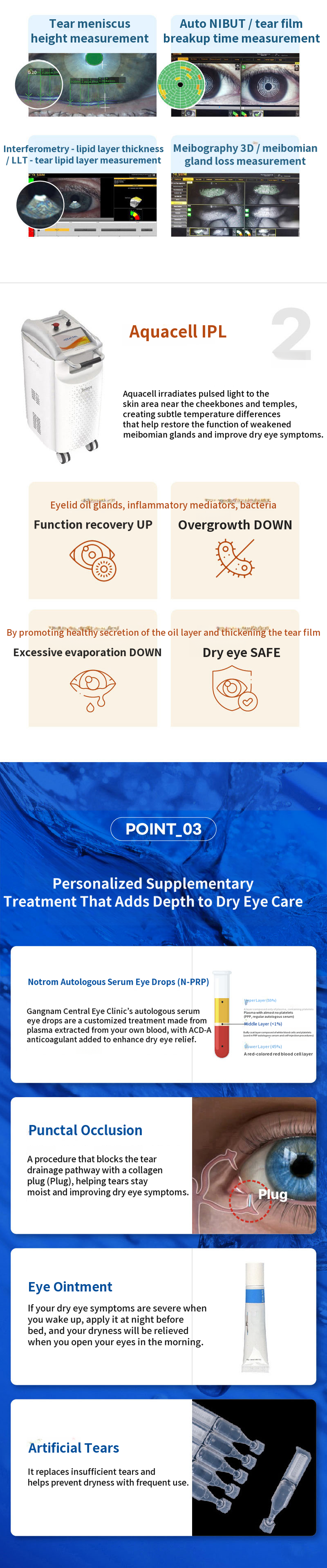 Customized IPL Treatment for Dry Eye Syndrome