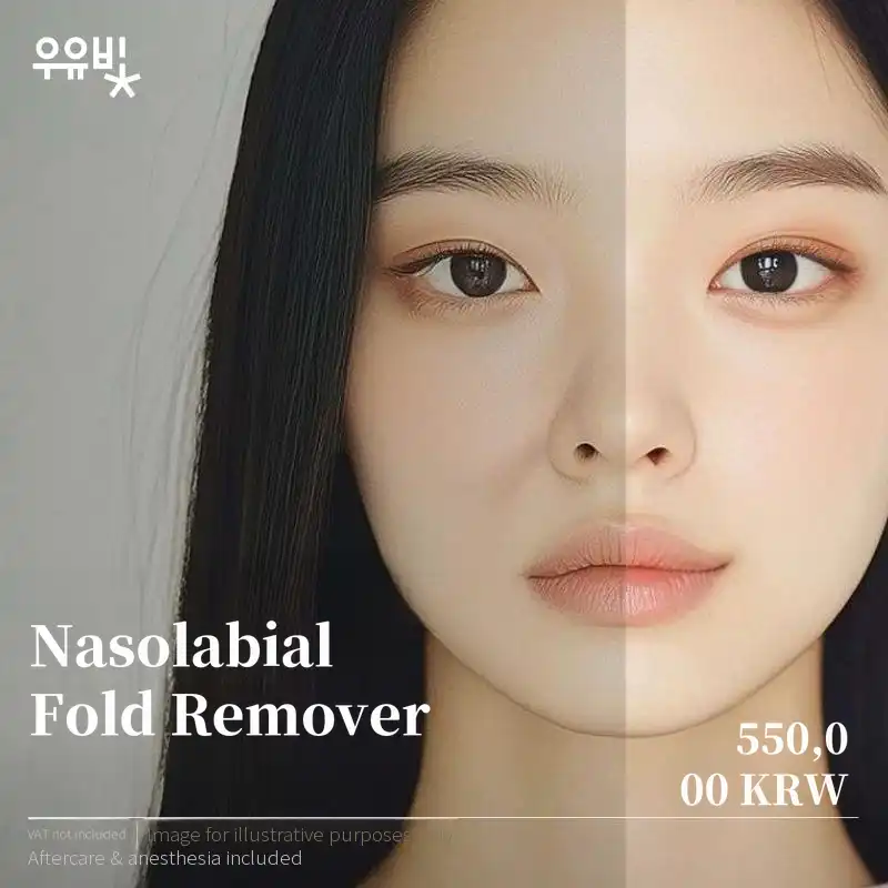 Nasolabial Fold Remover