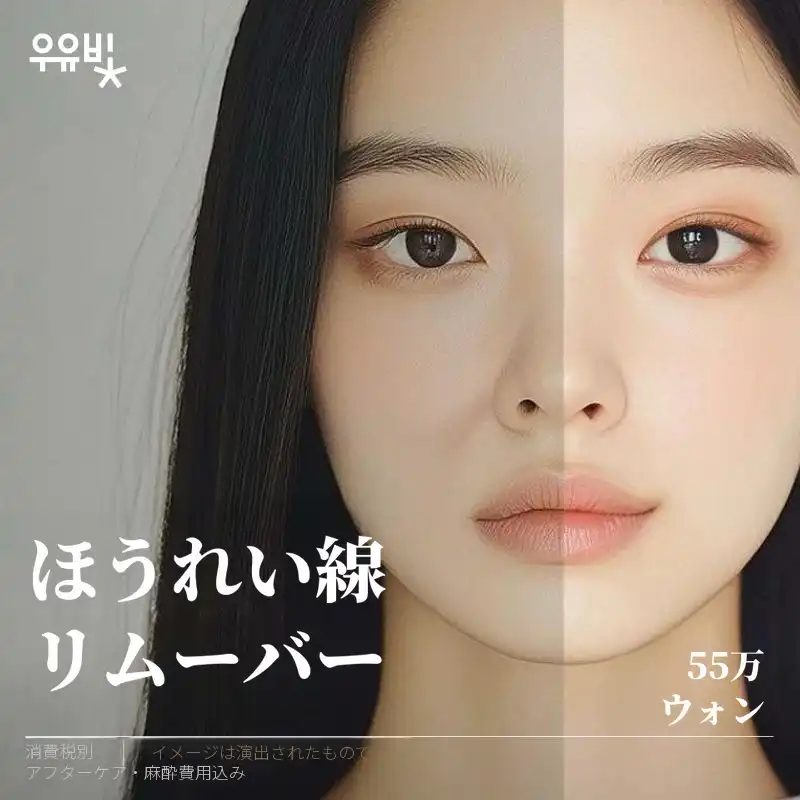 ほうれい線リムーバー