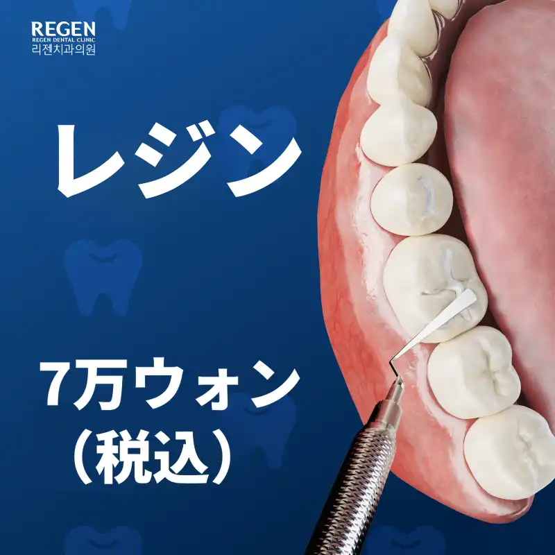 レジン 7万ウォン