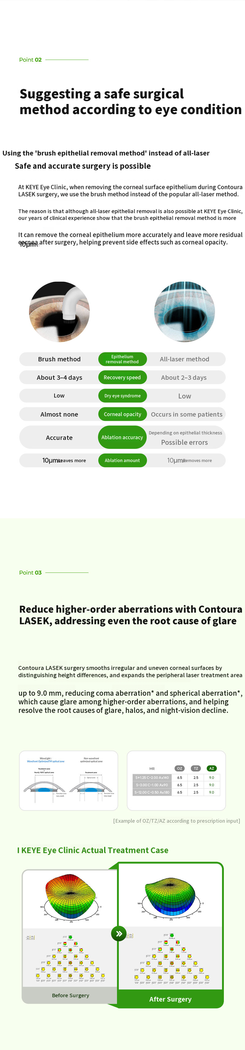 Personalized Contoura LASIK Special Offer