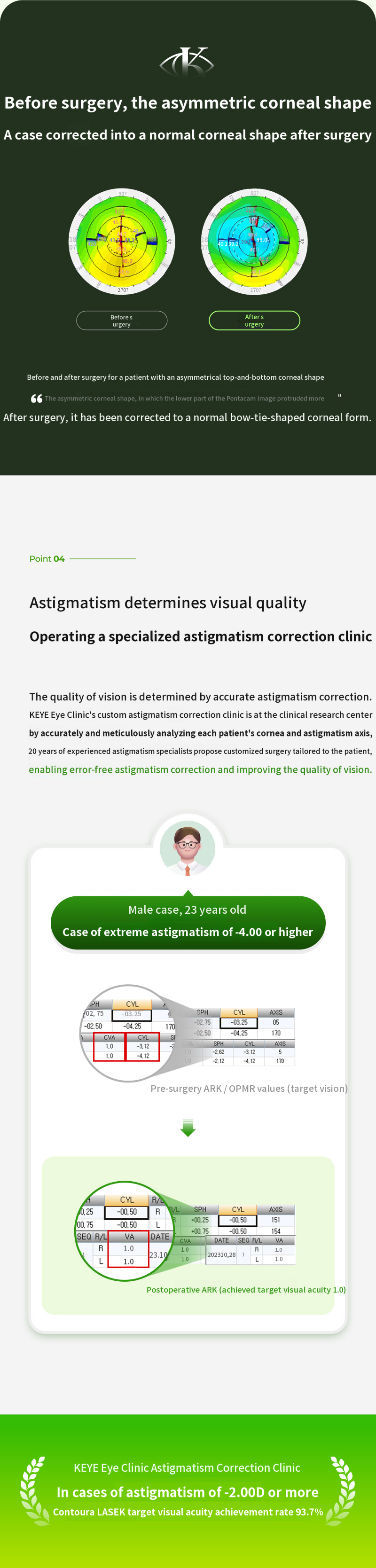 Personalized Contoura LASIK Special Offer