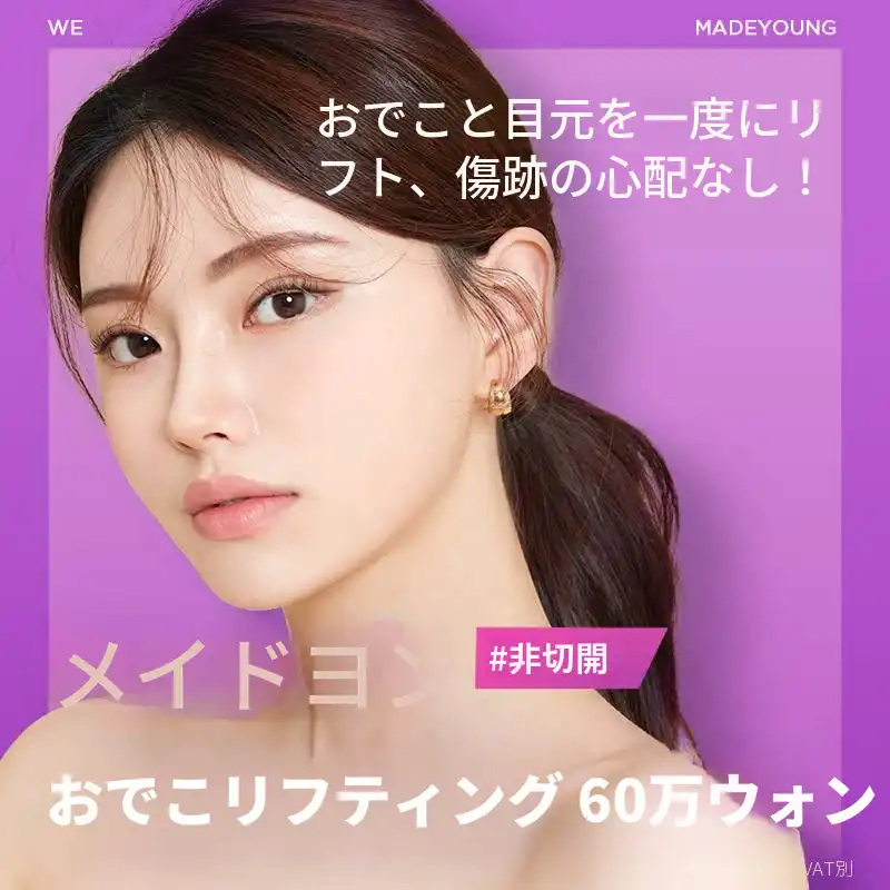 非切開 おでこリフト