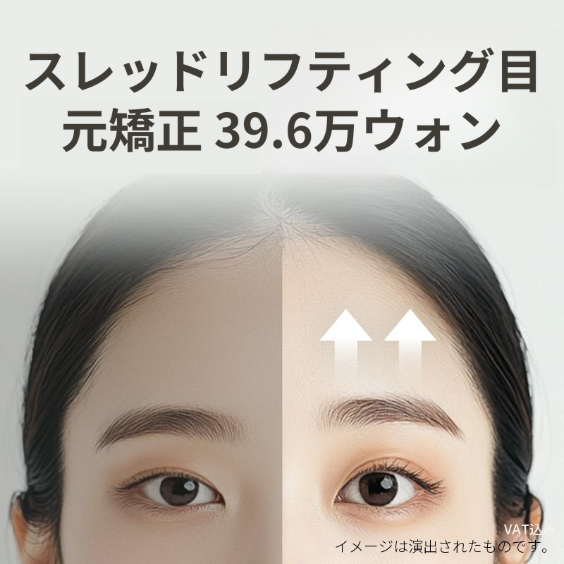 目のライン修正 おでこシリフト