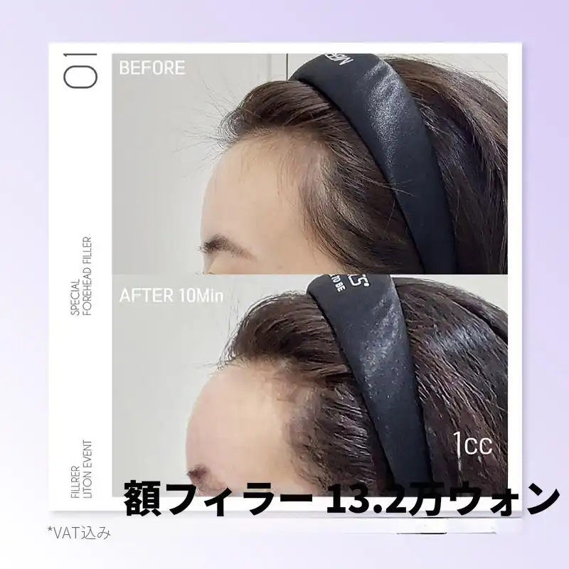 リフトン おでこフィラー