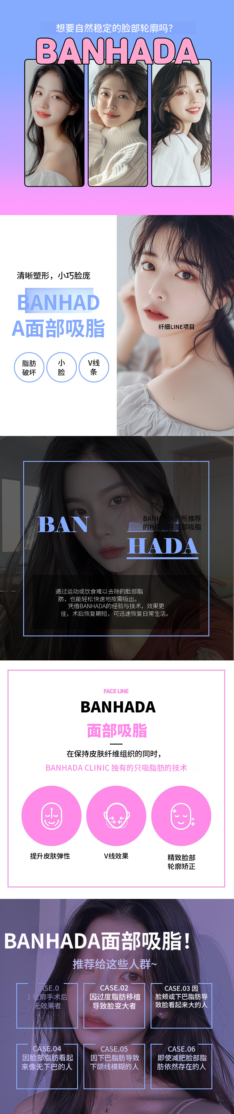 修长脸型 双下巴脂肪吸引